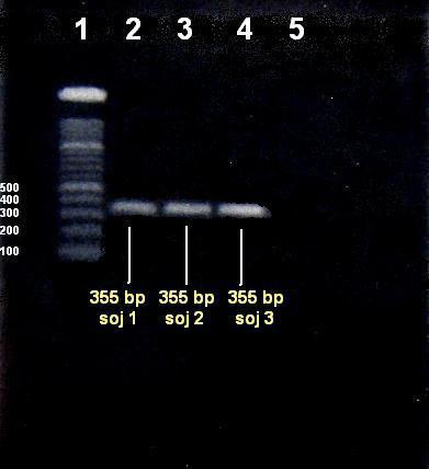 Slika 5. Elektroforeza na agaroza gelu amplificiranih PCR-produkata u uzorcima DNA izolirane iz tri soja pneumokoka.