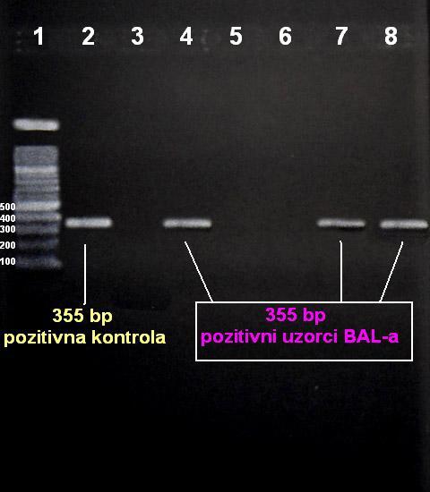 stupac 12, negativna kontrola (sterilna destilirana voda). Slika 7. Elektroforeza na agaroza gelu amplificiranih PCR-produkata u uzorcima BAL-a.
