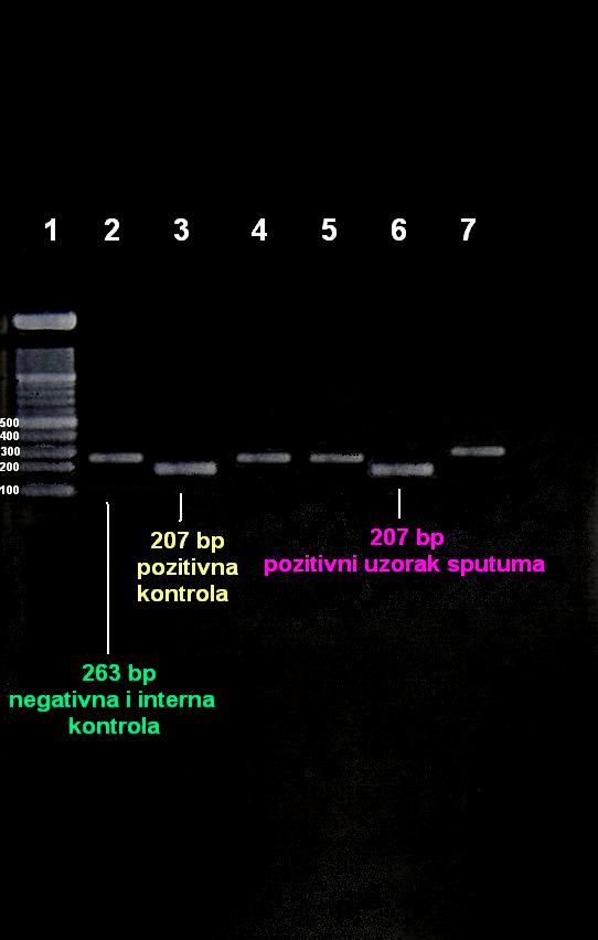 Slika 10. Elektroforeza u agaroza gelu amplificiranih PCR-produkata za M. pneumoniae u uzorcima sputuma (Venor Mp).