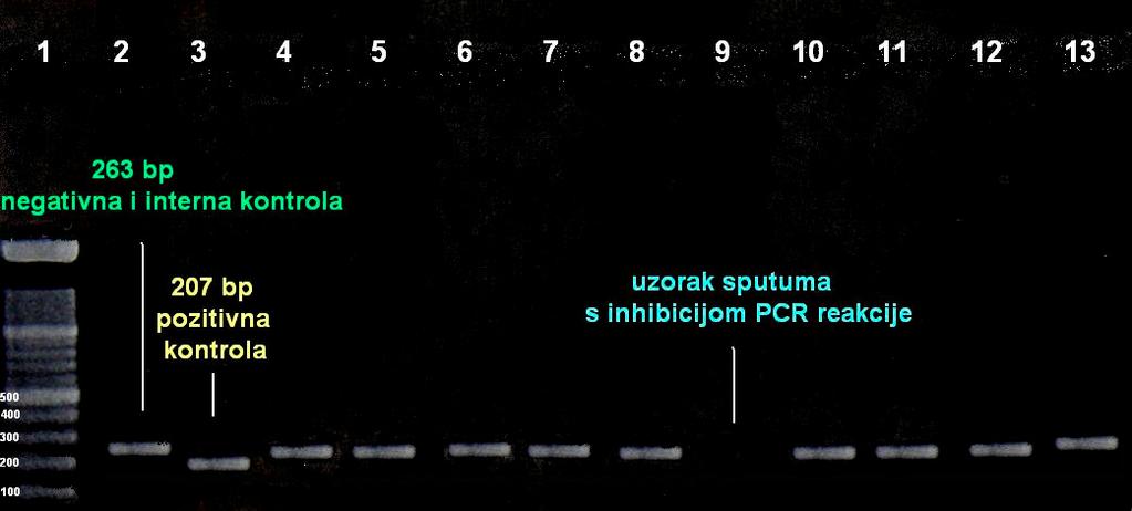 Slika 11. Elektroforeza u agaroza gelu amplificiranih PCR-produkata za M. pneumoniae u uzorcima sputuma (Venor Mp).