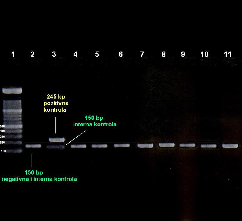 Slika 12. Elektroforeza u agaroza gelu amplificiranih PCR-produkata za Legionella species u uzorcima sputuma (Onar Ls).