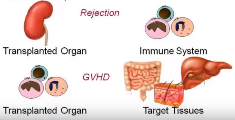 Graft-versus-Host Disease (GVHD) Background GVHD is an immunologic