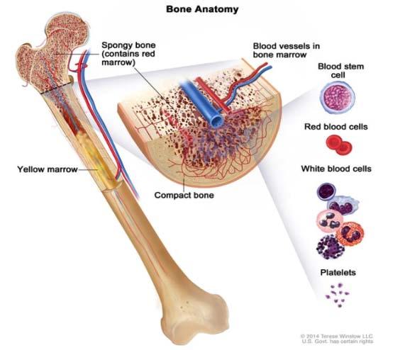 HSCT as curative treatment for blood cancer and inherited blood disorders Basic principle of HSCT 1. Destroy the diseased bone marrow 2.