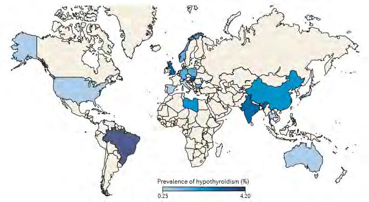 Prevalence Figure 2. Map of overt hypothyroidism prevalence 4. Taylor P, Albrecht D, Scholz A, Gutierrez-Buey G, Lazarus J, M.