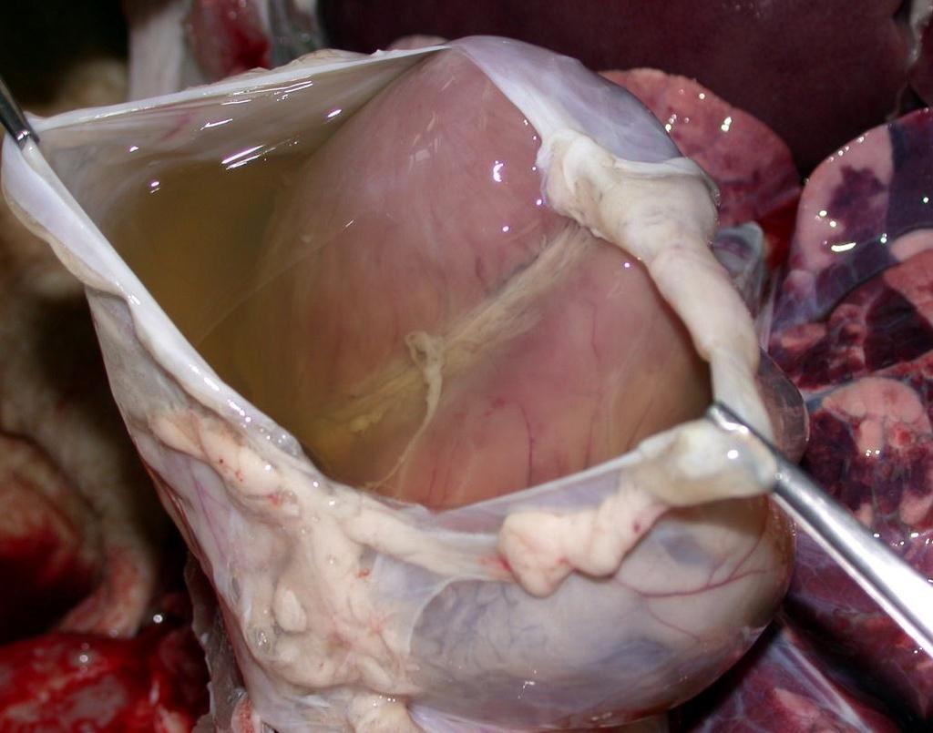 pericardial sac patchy red areas evident on the epicardium &
