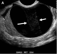 normal flow in the ovary.