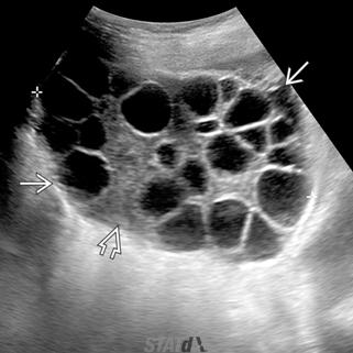 shows an enlarged ovary (white solid arrow) composed of numerous differentsized