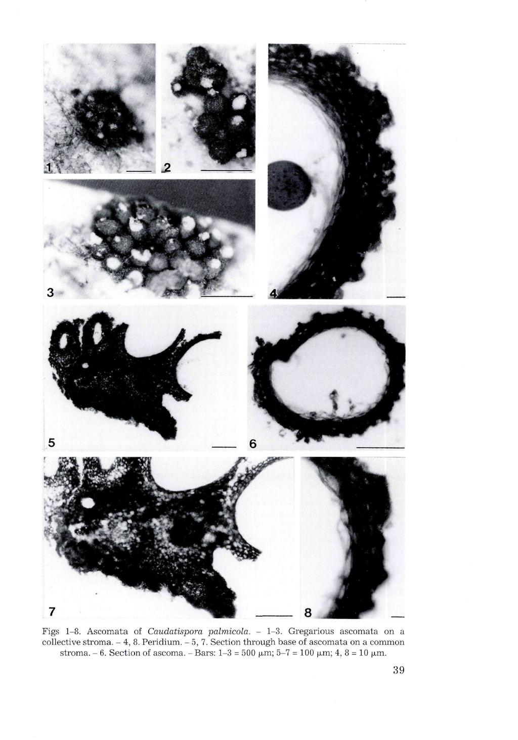Figs 1-8. Ascomata of Caudatispora palmicola. - 1-3. Gregarious ascomata on a collective stroma. - 4, 8. Peridium. - 5, 7.