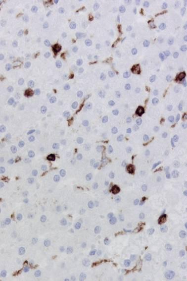 CD45 - Leucocyte common