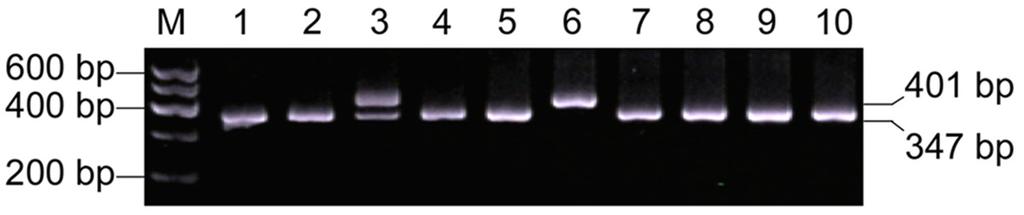 Figure 1. PER3 VNTR polymorphisms. The PER3 VNTR genotypes were typically shown by 2.5% of agarose gel electrophoresis from PCR products.