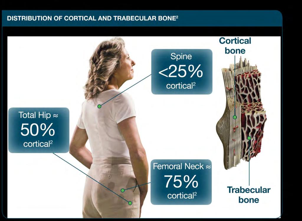 Osteoporotic fractures are caused by both cortical and trabecular bone loss 1 Most cortical bone loss occurs between 65 and 79 years of age 1 Targeting both cortical and trabecular bone is important