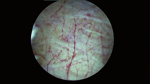 Clear and razor-sharp endoscopic images in FULL HD ## Natural