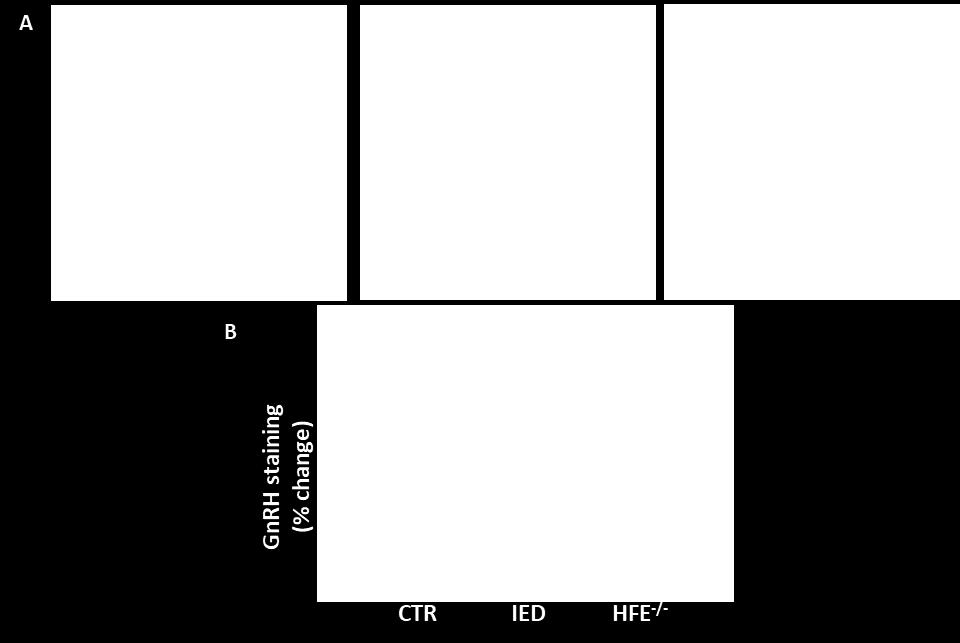 White bar is control (CTR) mice and the black ones are ironenriched diet (IED) mice. Data are representative of 3 mice. Data are expressed as percentage of control (mean ± SEM).