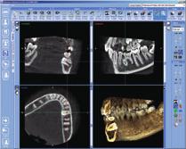 Third molars, maxillary cuspids, supernumerary teeth, and impactions challenge the clinician to identify