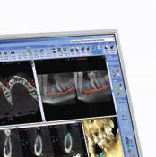 ProMax 3D, enables flexible viewing in all three relevant projections: axial, coronal, and