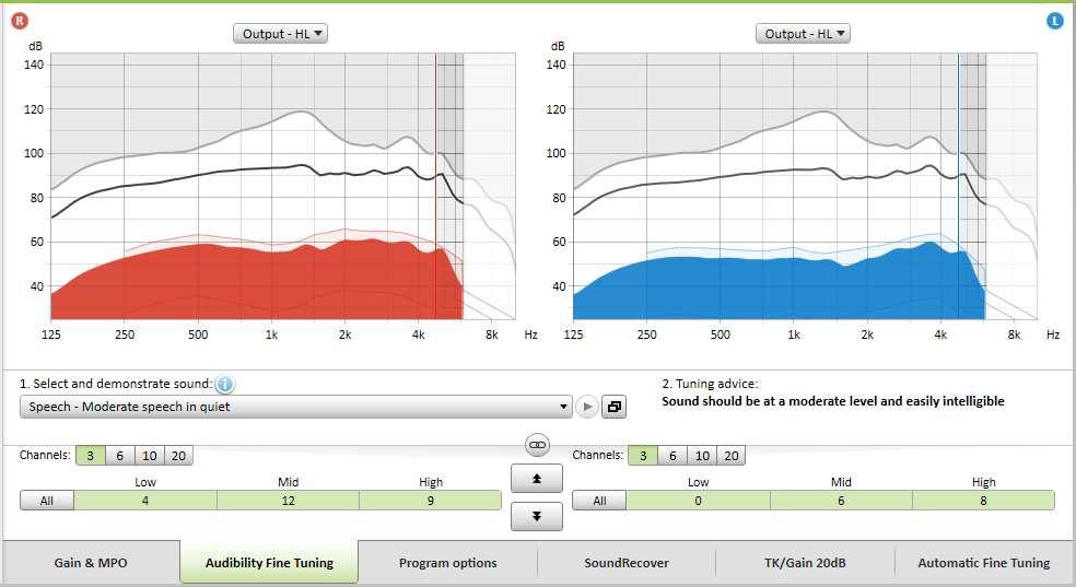 To modify the MPO in all channels together, click [MPO] shown on the left beside the MPO values. The overall gain can be changed by clicking [Gain].