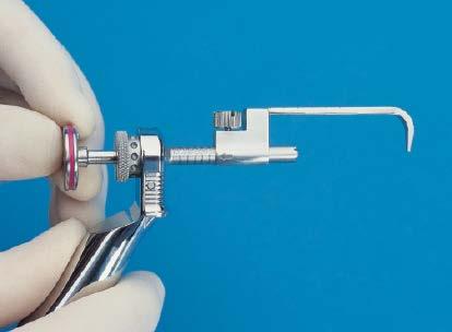 Place the lag screw device on the mandible perpendicular to the fracture line.