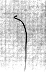 Fig. 4. Photograph showing the tip of the microcatheter curved on a horizontal plane to its axis. A two-dimensional No.
