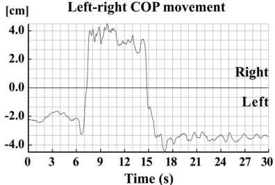 Kinetic measures Difference between the mean positions of COP before and after the dynamic task Absolute values of the COP