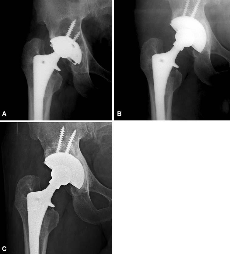 1504 Min et al. Clinical Orthopaedics and Related Research Fig.