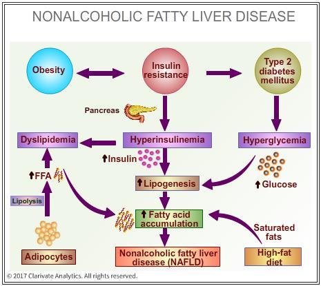 What are the symptoms and risk factors for NAFLD and NASH?