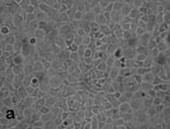 Virus isolation After ten days of incubation, CPE was clearly visible in both EPC and RTG-2 cultures Figure 1.