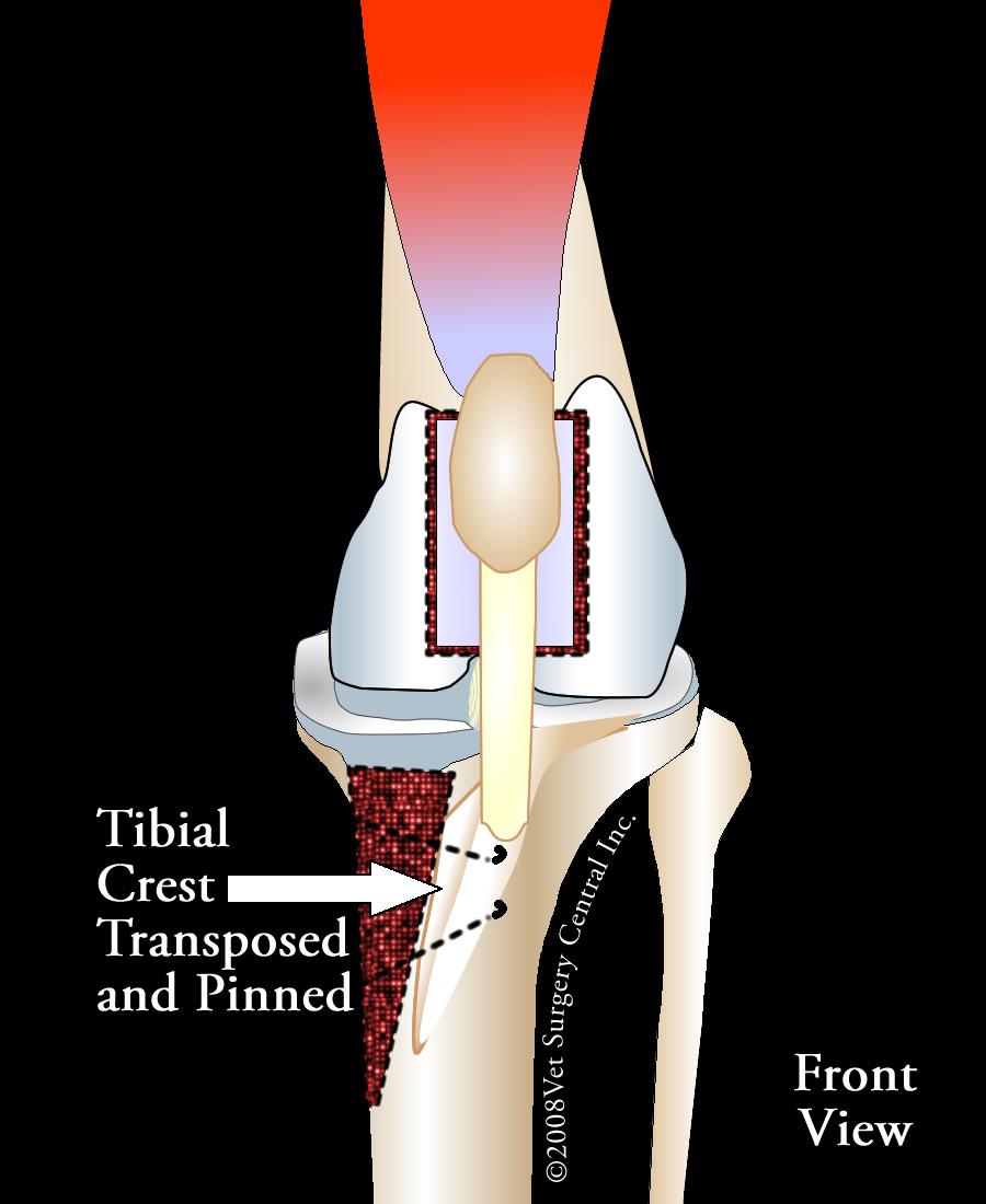Corrective Osteotomies A corrective osteotmies is the repositioning of the lateral patellar luxation and is accomplished by medial and lateral arthrotomy incisions on either side of the patella,