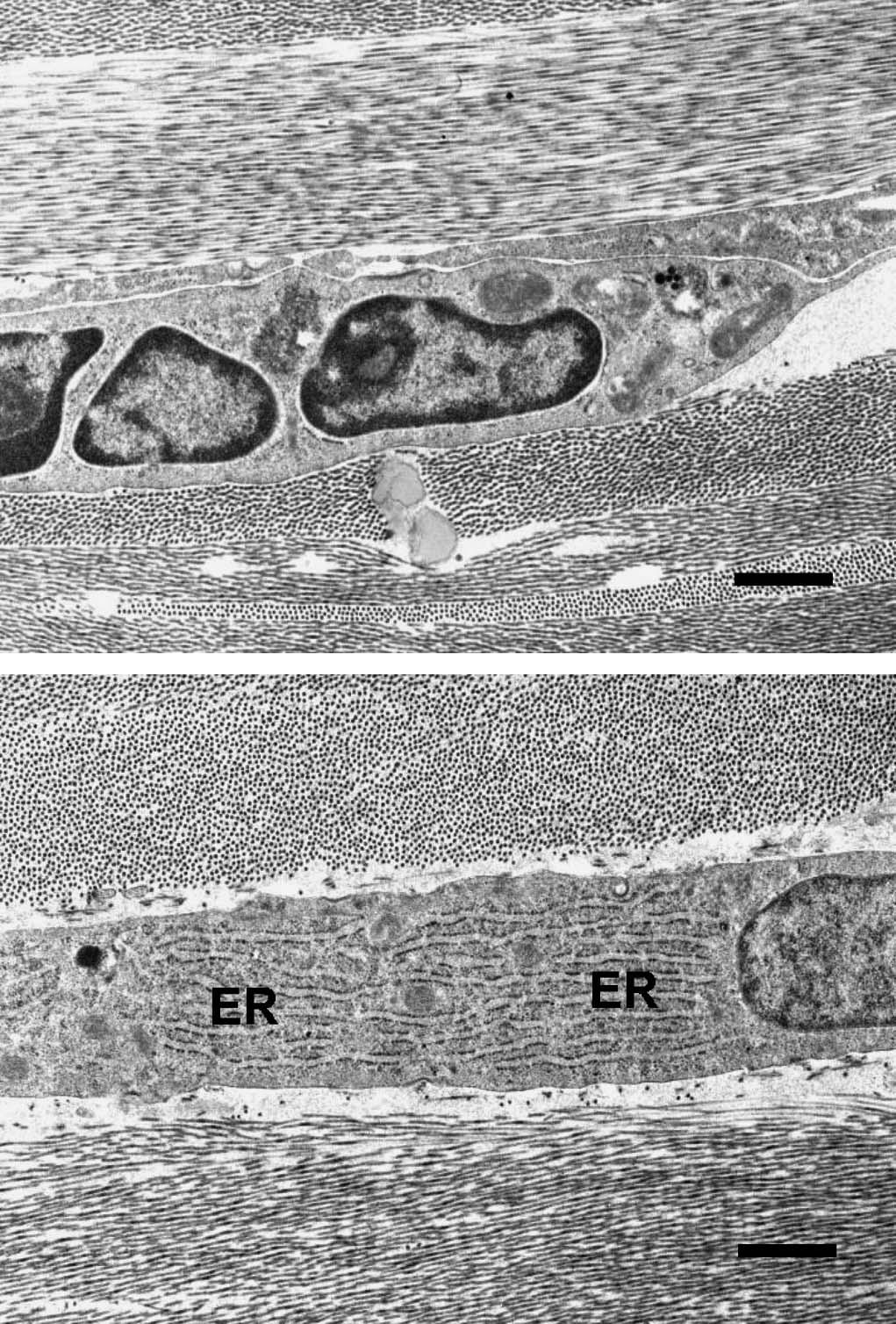 Gooi et al Cornea Volume 26, Number 7, August 2007 FIGURE 4. Transmission electron photomicrograph of keratocytes found in the operated cornea.
