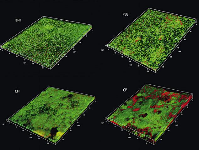 Fig 3 Biofilm images obtained by confocal laser scanning microscopy followed by 3D reconstruction; with a 63 magnification Green indicates live bacteria; red indicates dead bacteria BHI - brain heart
