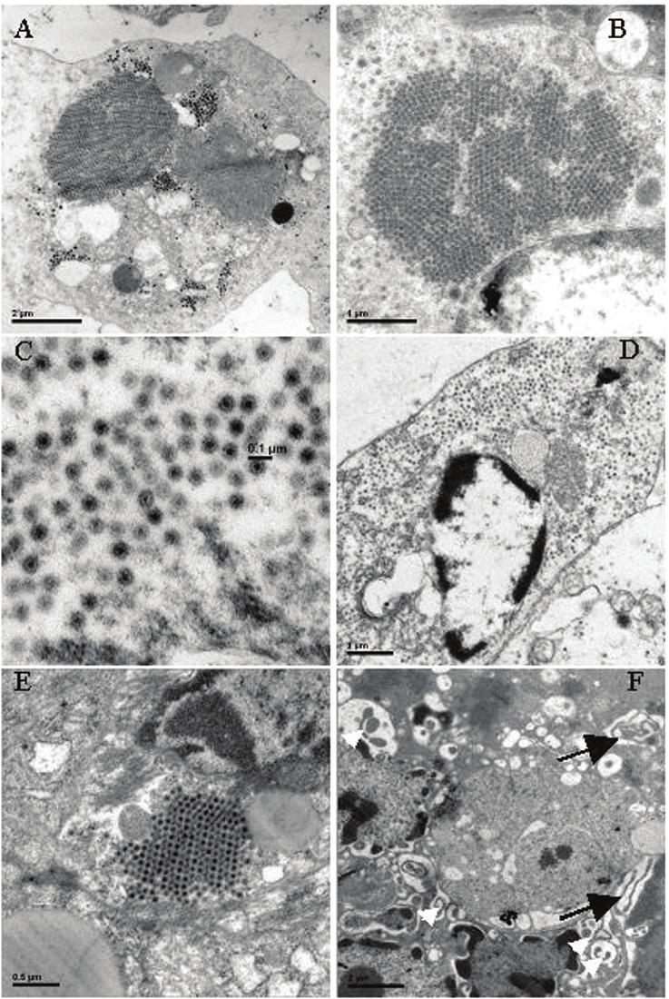 Chen et al. Figure 2. Ultrathin section of mud crab. Reo-like viruses and mollicutelike organisms infecting tissue of gill, intestine, stomach and heart. A. Gill (bar=2μm); B. Intestine (bar=1μm); C.