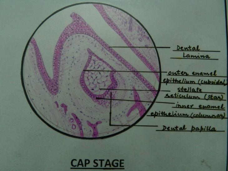 a) Outer Enamel Epithelium b) Inner Enamel Epiyhelium. c) Stellate Reticulum. 4 Outer and Inner Enamel Epithelium Cells of outer enamel epithelium- cuboidal and along convexity of cap.