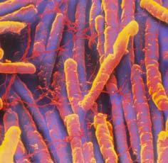 C difficile History A difficult bug 1935 Initially detected in fecal flora of healthy infants 1978 First case of reported c difficile infection Pseudomembranous colitis was a known entity related to
