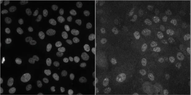 a sicontrol sibrca2 DAPI RAD51 b Nucleo-cytoplasmic intensity difference (AU) 80 60 40 20 0