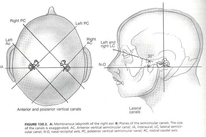 Semicircular canals are paired Horizontal canals Right superior/left posterior Left superior/right