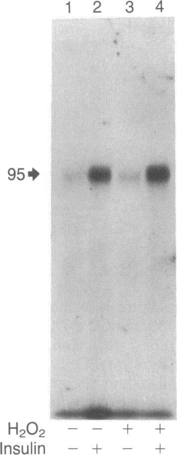 Phosphorylation was initiated by the addition of [32P]ATP. After 20 min at 24 C, the reaction was terminated by addition of unlabeled ATP and phosphatase inhibitors.