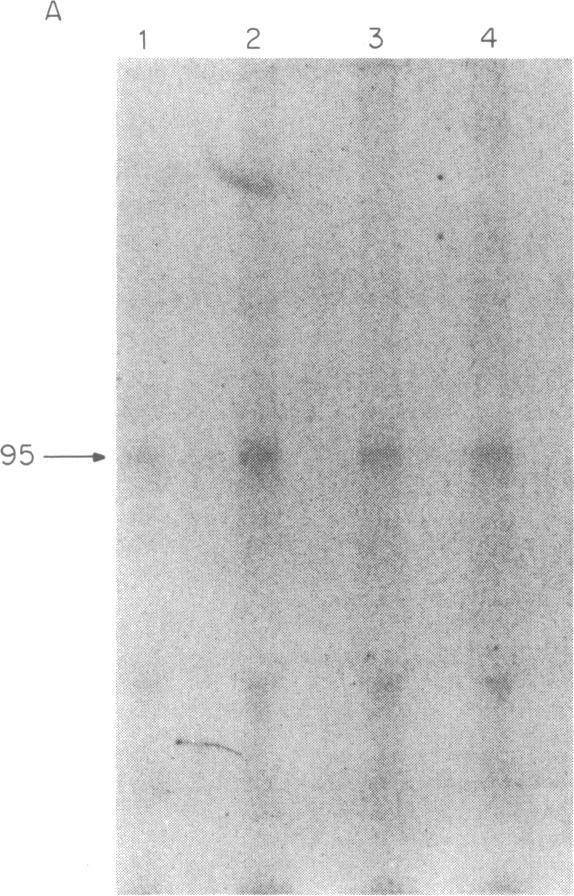 The arrow indicates the H202 - - 3subunit of the insulin receptor Insulin - - (shown as Mr x 10-s). and H202 stimulate receptor phosphorylation in adipocyte homogenates (Fig. 6A).