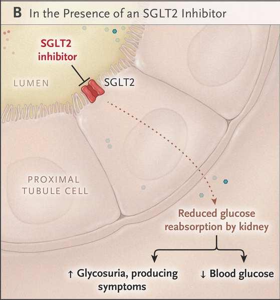 PRAM=pramlintide Renal Absorption of Glucose and Glucagon Secretion According Glycemia to the and Presence DKD: or drug Absence class of a effect Sodium- Coupled Glucose Transporter Type 2 (SGLT2)
