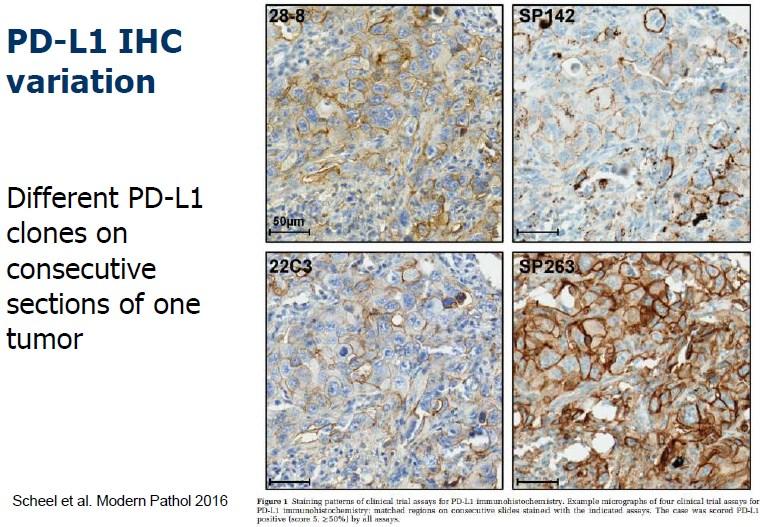 Studies comparing approved PDL1 IHC assays: German harmonization and IASCL Blueprint study Extracellular epitope Extracellular epitope Cytoplasmic epitope Extracellular epitope TC IC Blueprint: