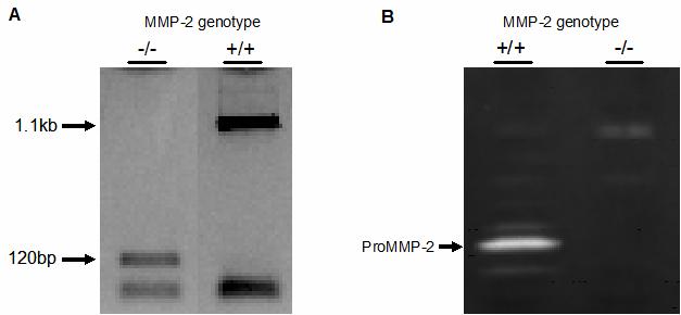 Figure 2.1 Confirmation of MMP-2 genotype of mice (A) Representive PCR for MMP-2 genotyping is shown. The 1.