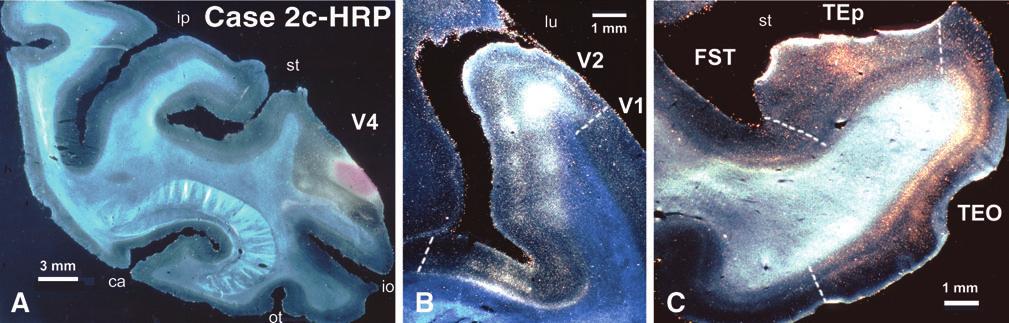 Figure 4. Photomicrographs of a representative case (Case 2c-HRP) illustrating the laminar distribution of cells and terminals following an injection into area V4.