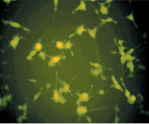 Figure 1. Stable high-level expression of GFP transductants in vitro. The human non-small lung cancer cell line Ma44-3 was transduced with the EGFP-N1 that expresses enhanced GFP.