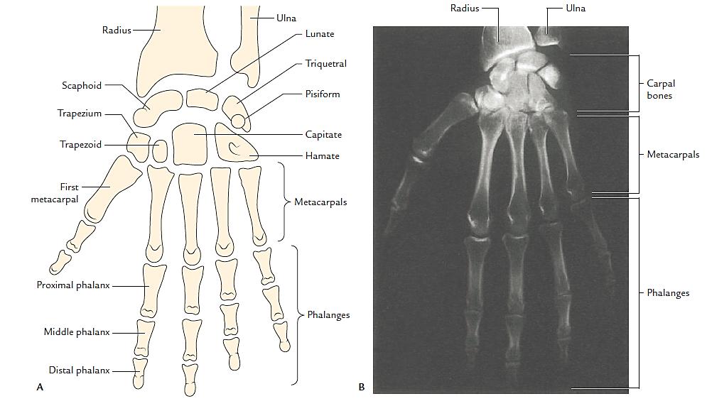 Figure 38: Bones of the hand The pisiform lies anterior to (above) the triquetrum. The trapezium and scaphoid have prominent tubercles while the hamate has a sharp hook.