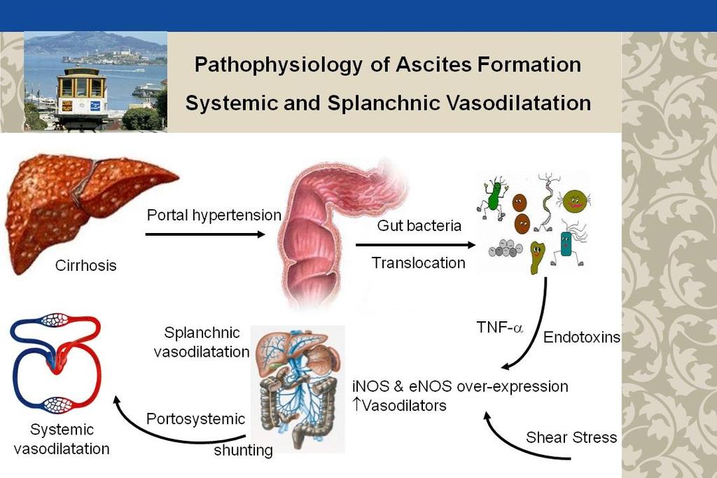 Pathophysiology of Ascites Formation