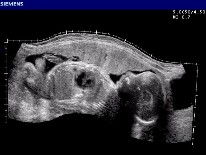 The Versatility of Ultrasound in Medicine 11 Safe enough for prenatal