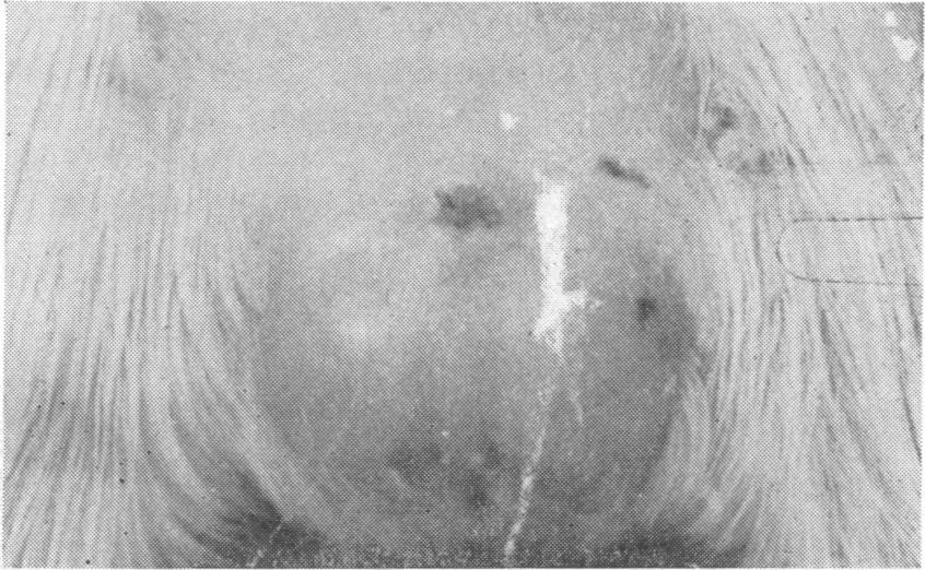 EFFECT OF CORTISONE ON EXPERIMENTAL SYPHILIS-II Natur-e of the Lesions.