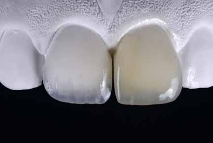 choice and application of proven dental adhesives.