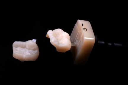 Saturday Advances in direct and semi-(in)direct CAD/CAM restorative dentistry for the posterior dentition Direct composite resin restorations have become the daily bread of restorative dentistry.