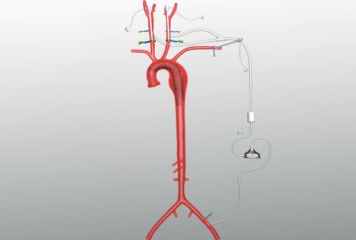with cerebral circulatory support: an acute experimental study, Numan F,