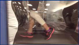 5 cm 2 2014 MFMER slide-11 Post-op 4 weeks PWB ROM as tolerated Early quad function Alter-G 4-8 weeks Normalize gait Closed
