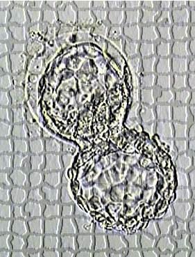 abnormalities Chromosomal mosaicism is a relatively common finding in IVF-derived human embryos and may affect: 15 90% of cleavage stage embryos 30-40% of blastocysts The exact threshold at which